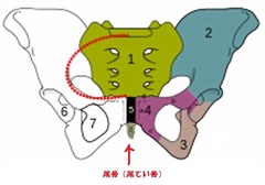 骨折 尾てい骨